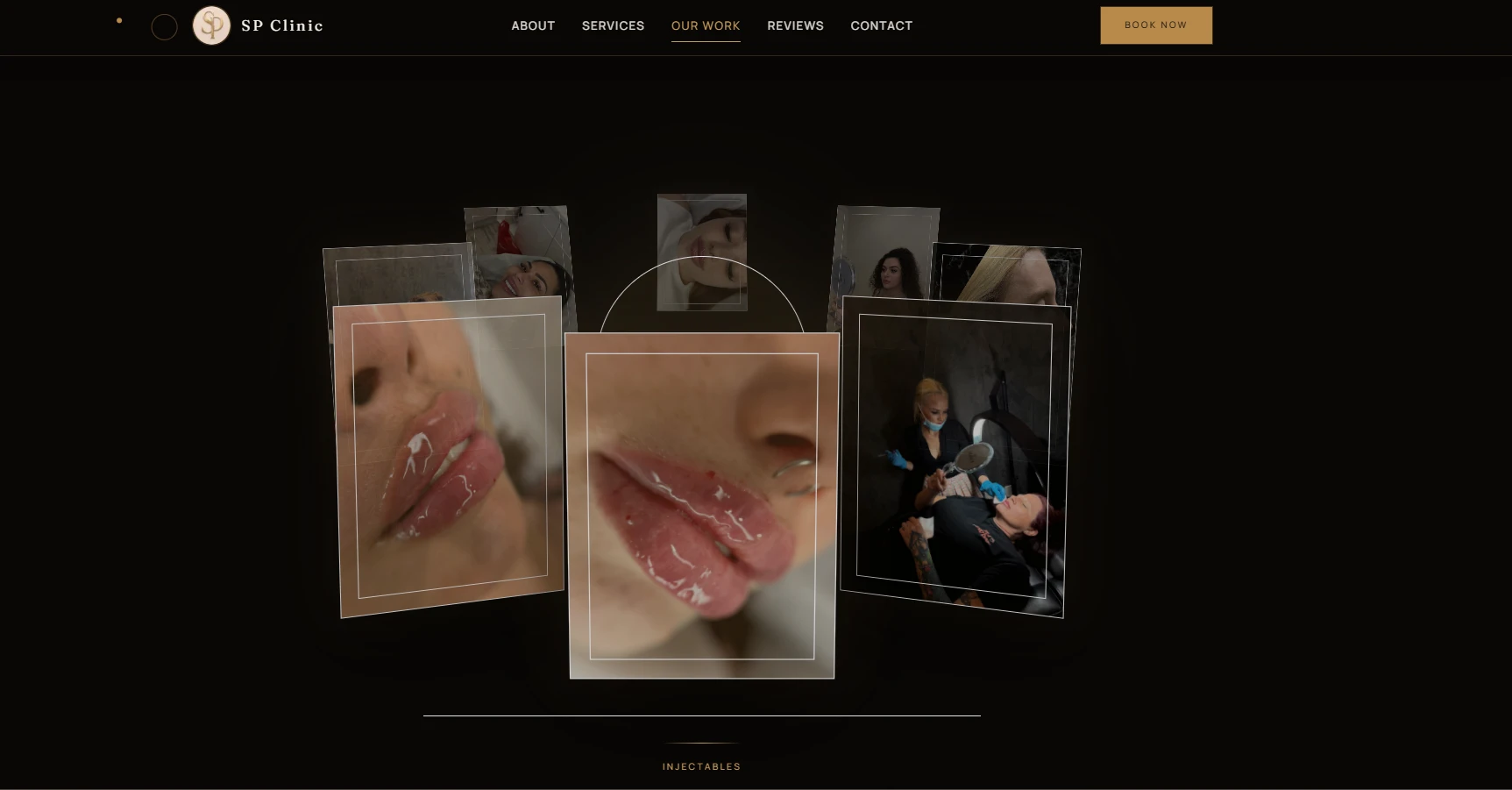 SP Clinic interactive 3D treatment gallery showcasing clinic work